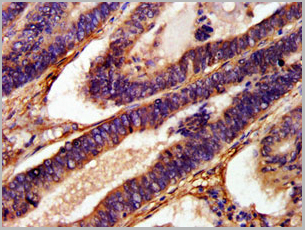 product-image-AAA26952_IHC2.jpg