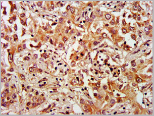 product-image-AAA26952_IHC3.jpg