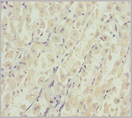 product-image-AAA26953_IHC3.jpg