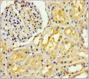 product-image-AAA26954_IHC.jpg