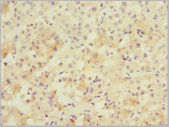product-image-AAA26955_IHC2.jpg