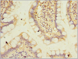 product-image-AAA26955_IHC3.jpg