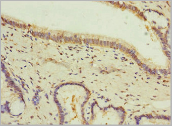 product-image-AAA26956_IHC2.jpg