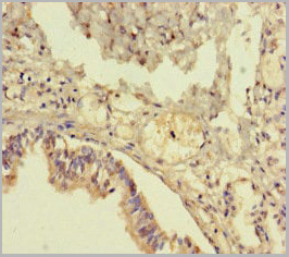 product-image-AAA26957_IHC2.jpg