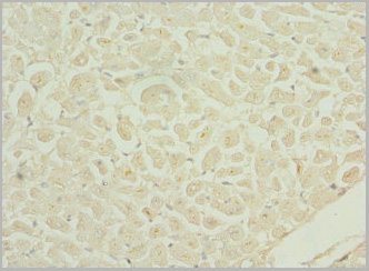 product-image-AAA26958_IHC.jpg