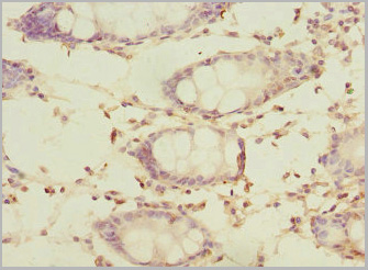 product-image-AAA26959_IHC3.jpg