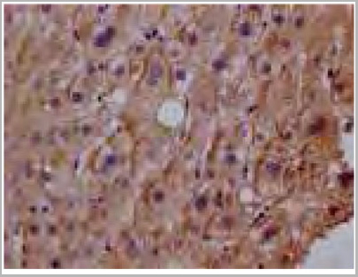 product-image-AAA26960_IHC3.jpg