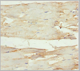 product-image-AAA26961_IHC2.jpg