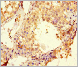 product-image-AAA26962_IHC2.jpg