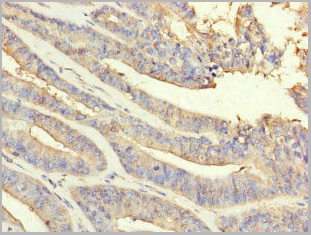product-image-AAA26963_IHC2.jpg