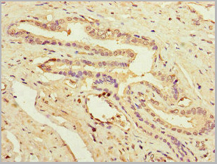 product-image-AAA26963_IHC3.jpg