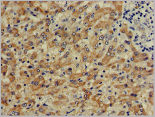 product-image-AAA26964_IHC2.jpg