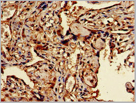 product-image-AAA26969_IHC.jpg