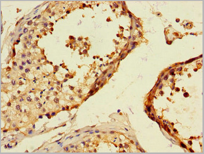 product-image-AAA26970_IHC2.jpg