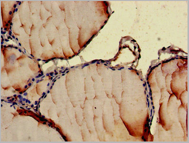 product-image-AAA26971_IHC2.jpg