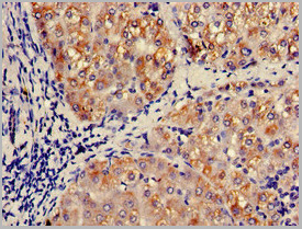 product-image-AAA26971_IHC3.jpg