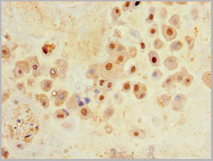 product-image-AAA26979_IHC.jpg