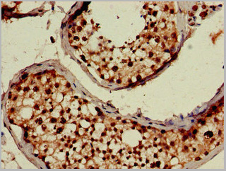 product-image-AAA26992_IHC2.jpg