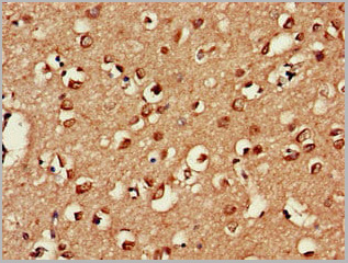 product-image-AAA26992_IHC3.jpg
