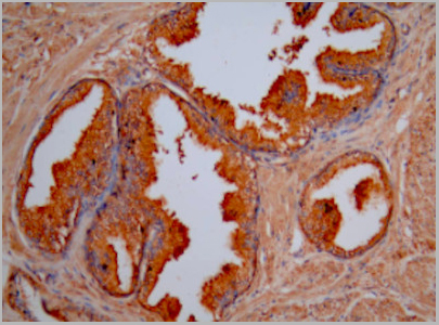 product-image-AAA26999_IHC2.jpg