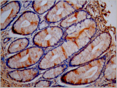 product-image-AAA26999_IHC3.jpg