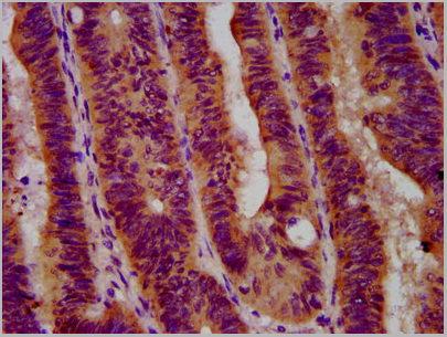product-image-AAA27004_IHC2.jpg