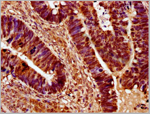 product-image-AAA27005_IHC2.jpg