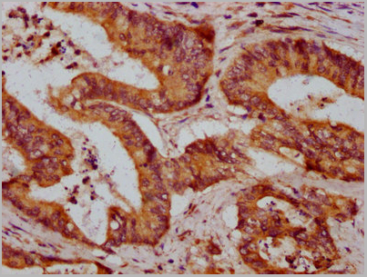 product-image-AAA27007_IHC2.jpg