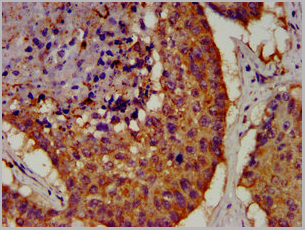 product-image-AAA27015_IHC3.jpg