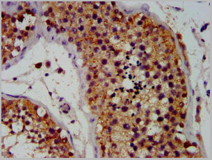 product-image-AAA27015_IHC4.jpg