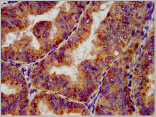 product-image-AAA27015_IHC6.jpg