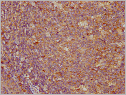 product-image-AAA27016_IHC3.jpg