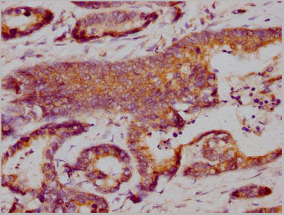product-image-AAA27016_IHC4.jpg