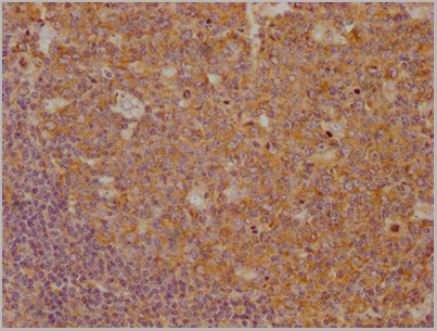 product-image-AAA27031_IHC9.png