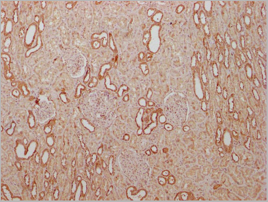 product-image-AAA27041_IHC12.jpg