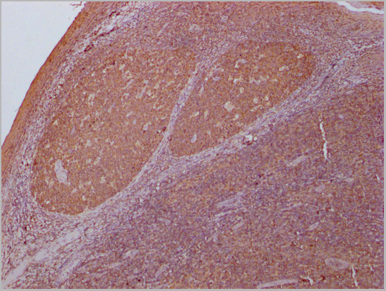 product-image-AAA27041_IHC6.jpg