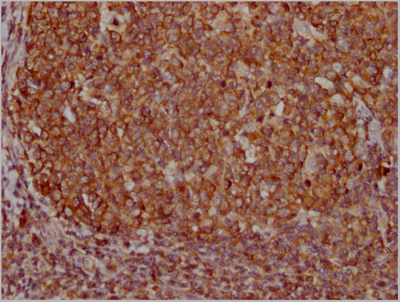 product-image-AAA27041_IHC8.jpg