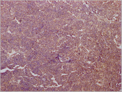 product-image-AAA27041_IHC9.jpg