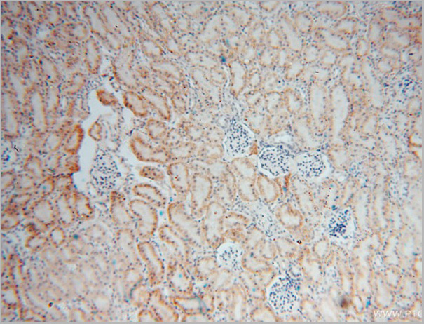 product-image-AAA27493_IHC.jpg