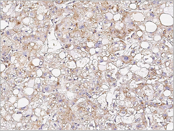 product-image-AAA27731_IHC3.png