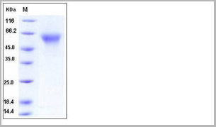 product-image-AAA27760_SDS_PAGE.jpg