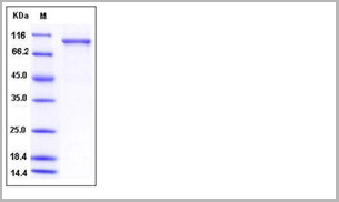 product-image-AAA27763_SDS_PAGE.jpg