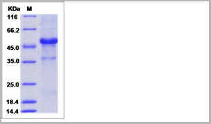 product-image-AAA27764_SDS_PAGE.jpg