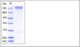 product-image-AAA27766_SDS_PAGE.jpg