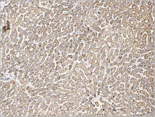 product-image-AAA27771_IHC2.png