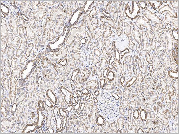 product-image-AAA27771_IHC3.png