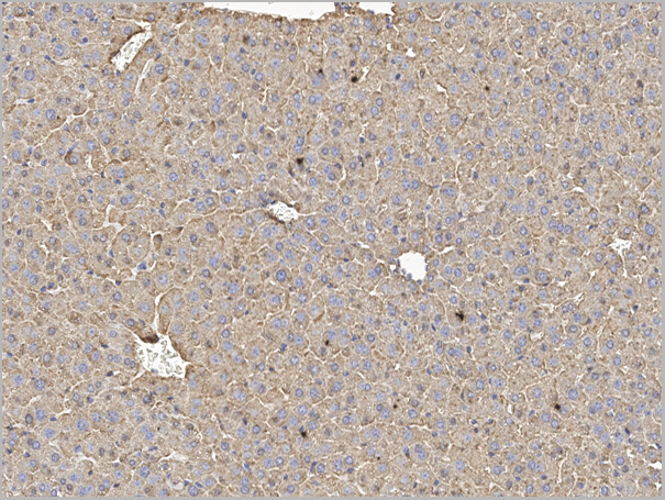 product-image-AAA27771_IHC4.png