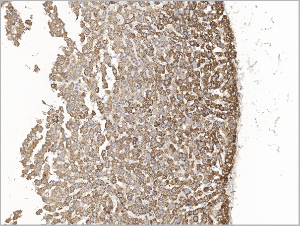 product-image-AAA27771_IHC5.png