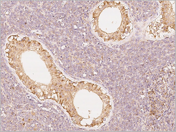 product-image-AAA27773_IHC3.png