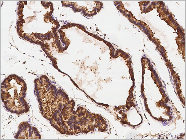 product-image-AAA27773_IHC4.png